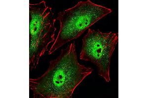Fluorescent image of A549 cells stained with Mouse Sirt1 Antibody (C-term) (ABIN6242824 and ABIN6577619). (SIRT1 抗体  (C-Term))