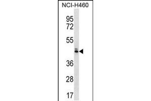 Western blot analysis in NCI-H460 cell line lysates (35ug/lane). (OR52N5 抗体  (C-Term))