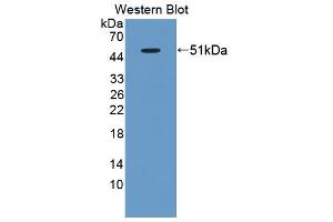 Western blot analysis of the recombinant protein. (BAFF 抗体  (AA 21-169))