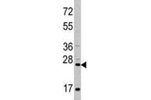 Western blot analysis of CD8A antibody and HeLa lysate. (CD8 alpha 抗体  (AA 59-88))