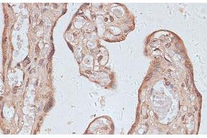 Immunohistochemistry of paraffin-embedded Human placenta using TLK1 Polyclonal Antibody at dilution of 1:100 (40x lens). (TLK1 抗体)