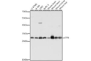 Western blot analysis of extracts of various cell lines, using ETFB antibody (ABIN7266916) at 1:1000 dilution. (ETFB 抗体  (AA 80-230))