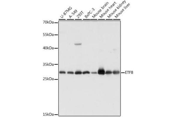 ETFB Antikörper  (AA 80-230)
