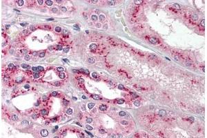 Human Kidney:  (formalin-fixed, paraffin-embedded) stained with TBXAS1 antibody ABIN214195 at 5 ug/ml followed by biotinylated goat anti-rabbit IgG secondary antibody ABIN481713, alkaline phosphatase-streptavidin and chromogen. (TBXAS1 抗体  (AA 359-377))