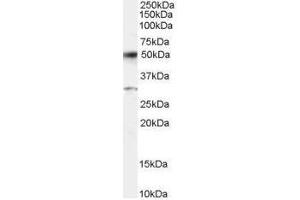 Image no. 1 for anti-Activating Transcription Factor 2 (ATF2) (C-Term) antibody (ABIN374122)
