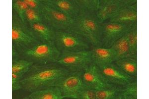 IF analysis of ALKBH5 using anti-ALKBH5 antibody (ABIN7602521) and anti-Tubulin Alpha antibody (ABIN7600339).