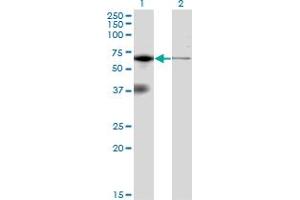 Western Blotting (WB) image for anti-Eukaryotic Translation Initiation Factor 2-alpha Kinase 2 (EIF2AK2) (AA 1-101) antibody (ABIN598901) (EIF2AK2 抗体  (AA 1-101))