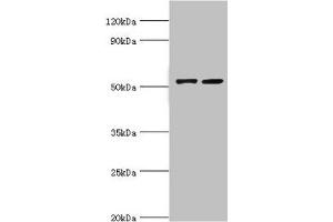 Western blot All lanes: CBLC antibody at 14 μg/mL Lane 1: A549 whole cell lysate Lane 2: Hela whole cell lysate Secondary Goat polyclonal to rabbit IgG at 1/10000 dilution Predicted band size: 53, 48 kDa Observed band size: 53 kDa (CBLC 抗体  (AA 245-474))