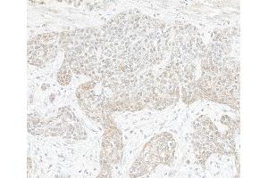 Immunohistochemistry (IHC) image for anti-TAF1 RNA Polymerase II, TATA Box Binding Protein (TBP)-Associated Factor, 250kDa (TAF1) (AA 1750-1800) antibody (ABIN7453573)