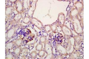 Formalin-fixed and paraffin embedded mouse kidney labeled with Anti-Megalin Polyclonal Antibody, Unconjugated (ABIN750988) at 1:200 followed by conjugation to the secondary antibody and DAB staining