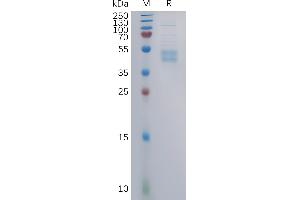 SDS-PAGE (SDS) image for Chemokine (C-C Motif) Receptor 6 (CCR6) (AA 1-47) protein (mFc Tag) (ABIN7491149)