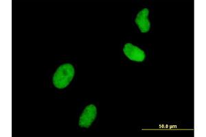 Immunofluorescence of monoclonal antibody to UHRF1 on HeLa cell. (UHRF1 抗体  (AA 694-793))