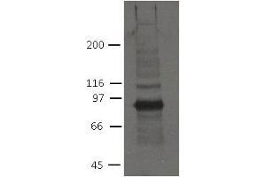 Image no. 1 for anti-Plakophilin 2 (PKP2) (AA 1-350) antibody (ABIN1169700) (Plakophilin 2 抗体  (AA 1-350))