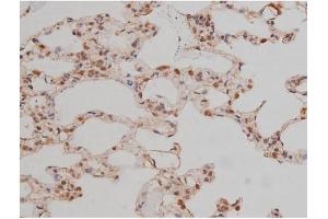 ABIN6267334 at 1/200 staining Rat lung tissue sections by IHC-P. (SP1 抗体  (pThr739))