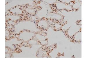 ABIN6267334 at 1/200 staining Rat lung tissue sections by IHC-P.