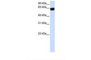 Image no. 1 for anti-Phosphatidylinositol Glycan T (PIGT) (AA 434-483) antibody (ABIN6738311) (PIGT 抗体  (AA 434-483))