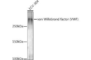 Western blot analysis of extracts of ECV-304 cells, using von Willebrand factor (VWF) antibody (ABIN3015449, ABIN3015450, ABIN5663874 and ABIN6217310) at 1:1000 dilution. (VWF 抗体  (AA 50-150))