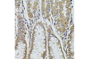Immunohistochemistry of paraffin-embedded human stomach using PDCD6IP antibody (ABIN1874065) at dilution of 1:100 (40x lens). (ALIX 抗体)