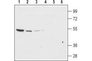 Western blot analysis of rat brain membrane (lanes 1 and 4), mouse brain (lanes 2 and 5) and mouse kidney lysates (lanes 3 and 6): - 1-3. (KCNJ13 抗体  (Extracellular Loop))