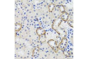 Immunohistochemistry of paraffin-embedded mouse kidney using MTERFD3 antibody. (MTERFD3 抗体  (AA 1-250))