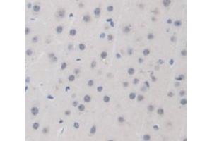 Immunohistochemistry (IHC) image for anti-Isocitrate Dehydrogenase 1 (NADP+), Soluble (IDH1) (AA 99-325) antibody (ABIN1859250)