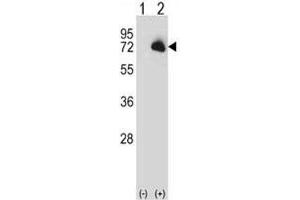 Western blot analysis of BTK antibody and 293 cell lysate (2 ug/lane) either nontransfected (Lane 1) or transiently transfected (2) with the BTK gene. (BTK 抗体  (AA 27-55))
