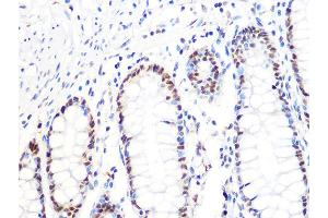 Immunohistochemistry of paraffin-embedded human colon using DKC1 Rabbit mAb (ABIN7266869) at dilution of 1:100 (40x lens). (DKC1 抗体)