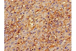 Immunohistochemistry (IHC) image for anti-Annexin A2 (ANXA2) (AA 2-339) antibody (ABIN7144268)
