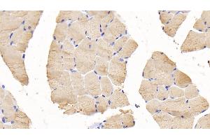 Detection of TNNI2 in Mouse Skeletal muscle Tissue using Polyclonal Antibody to Troponin I Type 2, Fast Skeletal (TNNI2) (TNNI2 抗体  (AA 1-182))