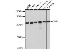 Western blot analysis of extracts of various cell lines, using DDR2 Rabbit mAb (ABIN7266790) at 1:1000 dilution. (DDR2 抗体)