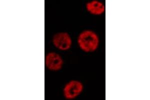 Immunofluorescence (fixed cells) (IF/ICC) image for anti-Minichromosome Maintenance Complex Component 2 (MCM2) (N-Term) antibody (ABIN6263158)