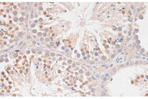 Immunohistochemistry of paraffin-embedded Mouse testis using MAD2L1 Polyclonal Antibody at dilution of 1:100 (40x lens). (MAD2L1 抗体)