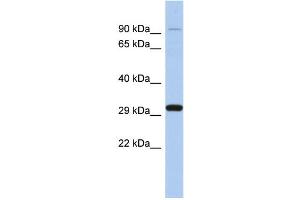 WB Suggested Anti-ENDOG Antibody Titration: 0. (Endonuclease G 抗体  (Middle Region))