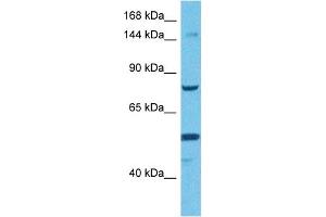 Host:  Rabbit  Target Name:  TMEM2  Sample Tissue:  Human HCT15 Whole Cell  Antibody Dilution:  1ug/ml (TMEM2 抗体  (Middle Region))
