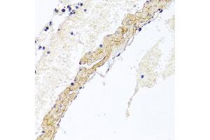 Immunohistochemistry of paraffin-embedded mouse lung using CD81 antibody at dilution of 1:100 (x40 lens). (CD81 抗体)