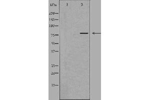 Western blot analysis of extracts from HUVEC cells, using NOL10 antibody. (NOL10 抗体  (C-Term))