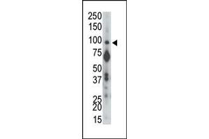 Western Blotting (WB) image for anti-Protein tyrosine Phosphatase, Receptor Type, A (PTPRA) (N-Term) antibody (ABIN360736) (PTPRA 抗体  (N-Term))