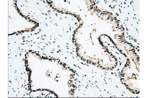 Immunohistochemistry (IHC) image for anti-Ubiquitin Specific Peptidase 5 (USP5) antibody (ABIN1501693)