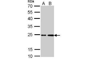 Western Blotting (WB) image for anti-HRas proto-oncogene, GTPase (HRAS) (C-Term) antibody (ABIN2857002)