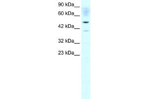 WB Suggested Anti-ACAT2 Antibody Titration:  1. (ACAT2 抗体  (Middle Region))