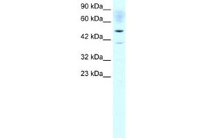 Western Blotting (WB) image for anti-Acetyl-CoA Acetyltransferase 2 (ACAT2) (Middle Region) antibody (ABIN2777595)
