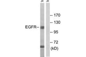 Western blot analysis of extracts from Jurkat cells, treated with UV 15', using EGFR (Ab-998) Antibody. (EGFR 抗体  (AA 966-1015))