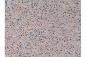 Figure. (Kallikrein 2 抗体  (AA 19-261))