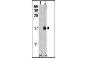 Western blot analysis of MAP1LC3B (arrow) using LC3B Antibody (T6) in Y79 cell line lysates and mouse brain tissue lysates (35 µg/lane). (LC3B 抗体  (N-Term))
