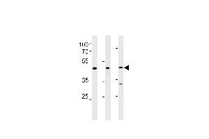NROB1 Antibody (N-term) (ABIN389157 and ABIN2839323) western blot analysis in Hela,NCI-,PC-3 cell line lysates (35 μg/lane). (NR0B1 抗体  (N-Term))