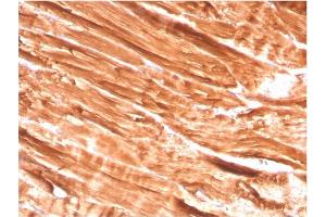 Formalin-fixed, paraffin-embedded human Skeletal Muscle stained with Dystrophin Monospecific Mouse Monoclonal Antibody (DMD/3242). (Dystrophin 抗体  (AA 114-263))