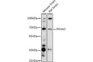 Western blot analysis of extracts of various cell lines, using P4H antibody (ABIN6132886, ABIN6145137, ABIN6145138 and ABIN6217878) at 1:3000 dilution. (P4HA3 抗体  (AA 20-110))