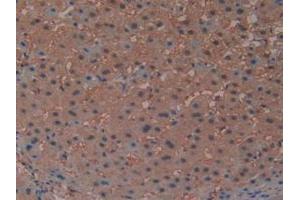 Immunohistochemistry (IHC) image for anti-Prostaglandin D2 Synthase (PTGDS) (AA 32-190) antibody (ABIN7432472)