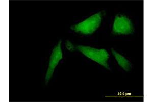 Immunofluorescence of purified MaxPab antibody to SSX2IP on HeLa cell. (SSX2IP 抗体  (AA 1-614))