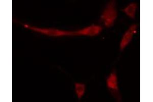 ABIN6274852 staining HeLa cells by IF/ICC. (APOA1BP 抗体  (Internal Region))